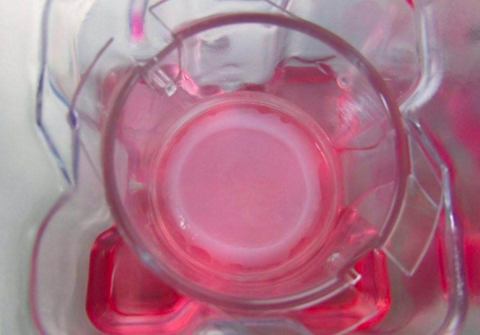 Poeitis 3D生物打印的皮肤样本 Poeitis 3D生物打印的皮肤样本