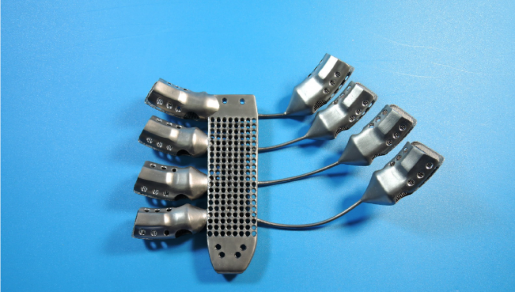 澳大利亚医疗器械公司Anotomics以前曾进行3D打印的钛肋骨植入物 澳大利亚医疗器械公司Anotomics以前曾进行3D打印的钛肋骨植入物