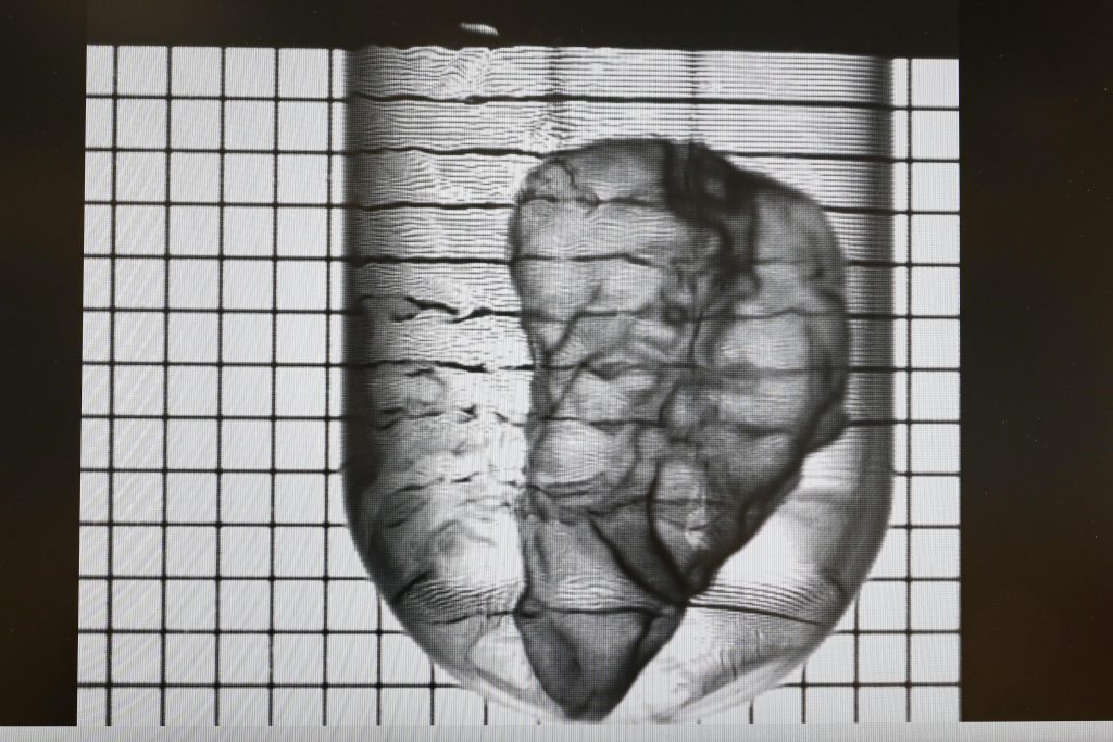 Ready3D 的迷你生物3D打印胰腺 Ready3D 的迷你生物3D打印胰腺