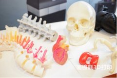 3D打印在神经外科方面有什么进展呢？