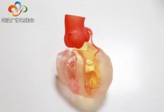 3D打印“加持” ，17岁少年精准实施二次心脏手术