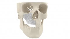 <b>3DӡMYBONEֲŷ޻ʹ</b>