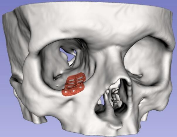 죡Fraunhofer˹ܵȫԶ3Dӡۿֲ