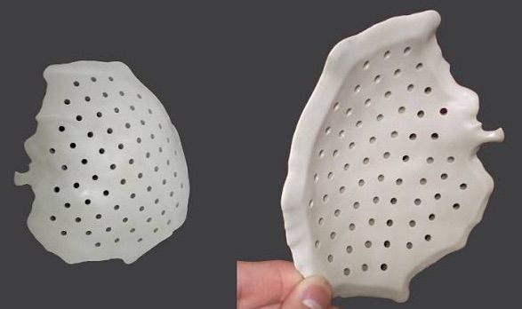 九院韦敏 | PEEK 3D在颅骨缺损方面的应用