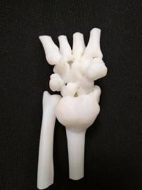 3D建模“量体裁衣”肿瘤患者“脱胎换骨”