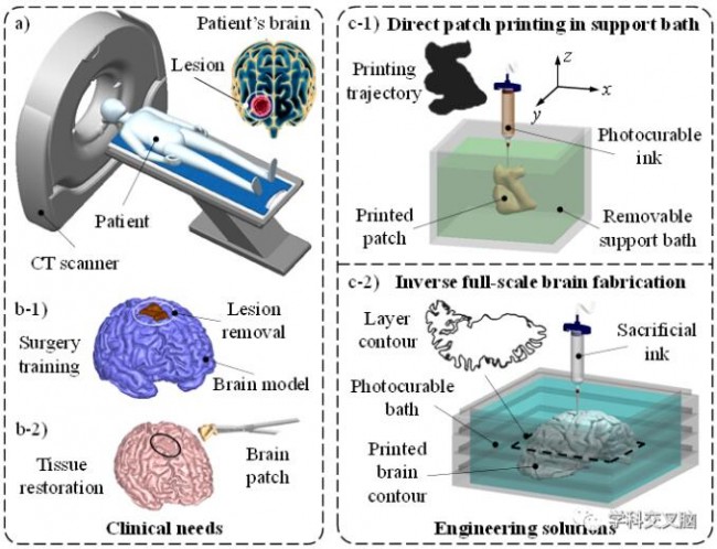 3D打印全尺寸人脑模型及临床应用前景