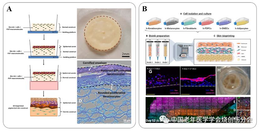 生物3D打印皮肤的研究进展及多样化临床应用路径