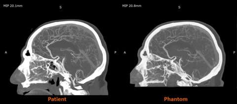 StratasysҽѧӰ÷3DӡϵӦ÷Χ
