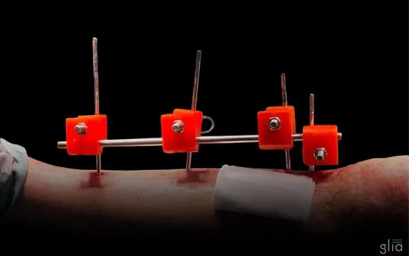 ��ɳҽ������Դ�ѷ��ش�����3D��ӡ�������������̶���