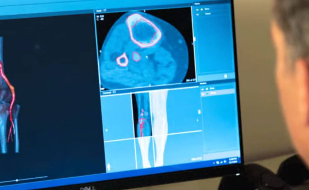 3D��ӡ���ܾ�׼�ǿƣ�3D Systems VSPƽ̨��FDA��׼�����������껼��